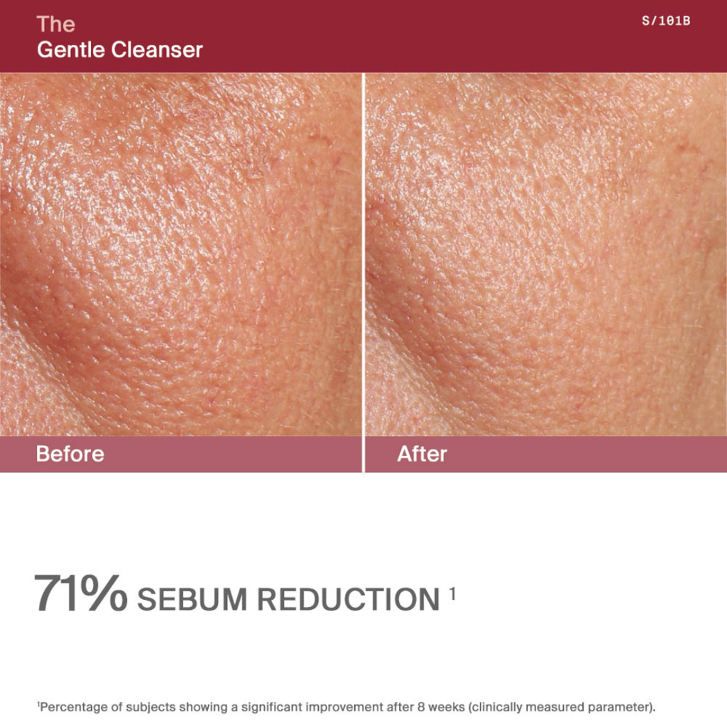 The Gentle Cleanser - Image 5
