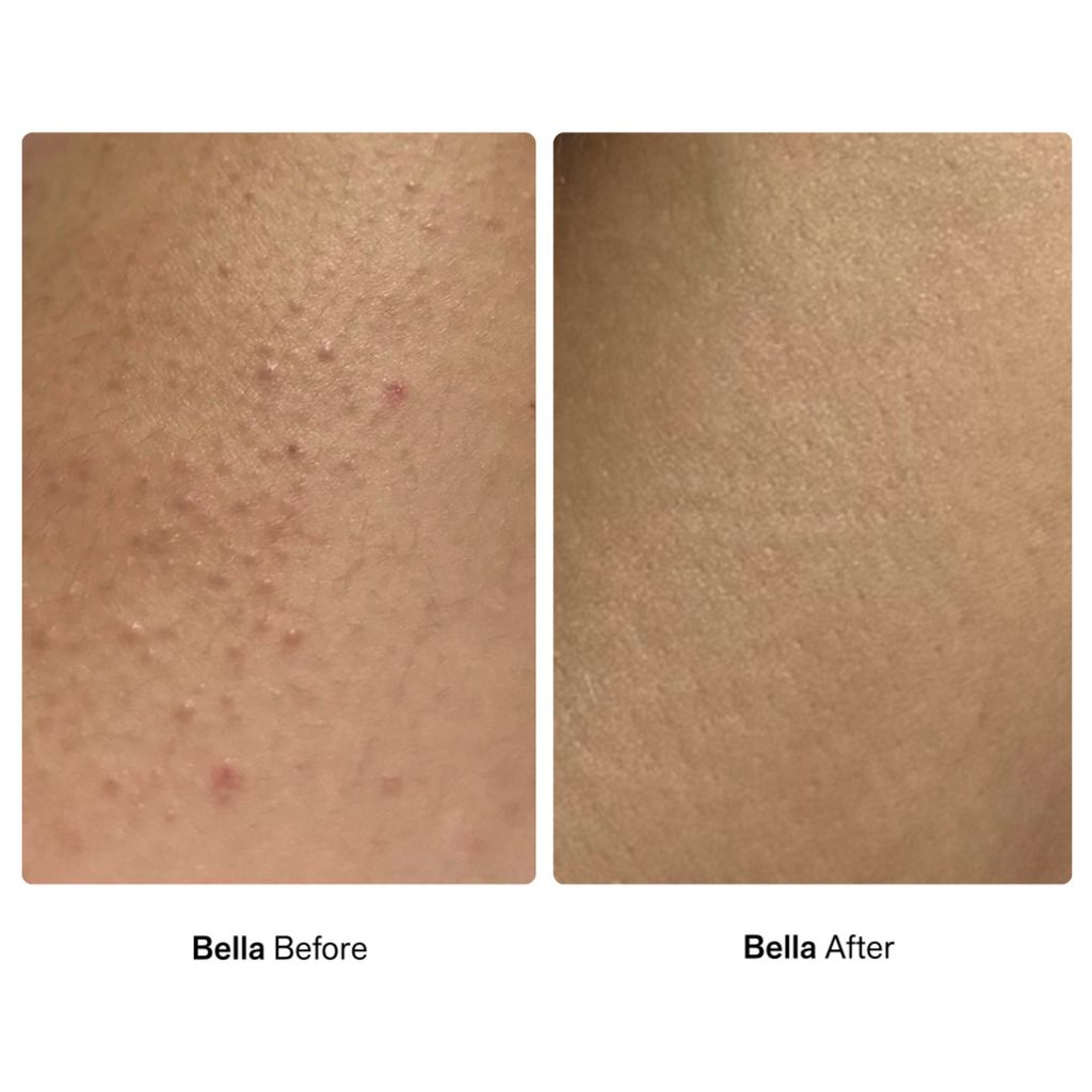 Bump Barrier Post Shave Oil - Image 7
