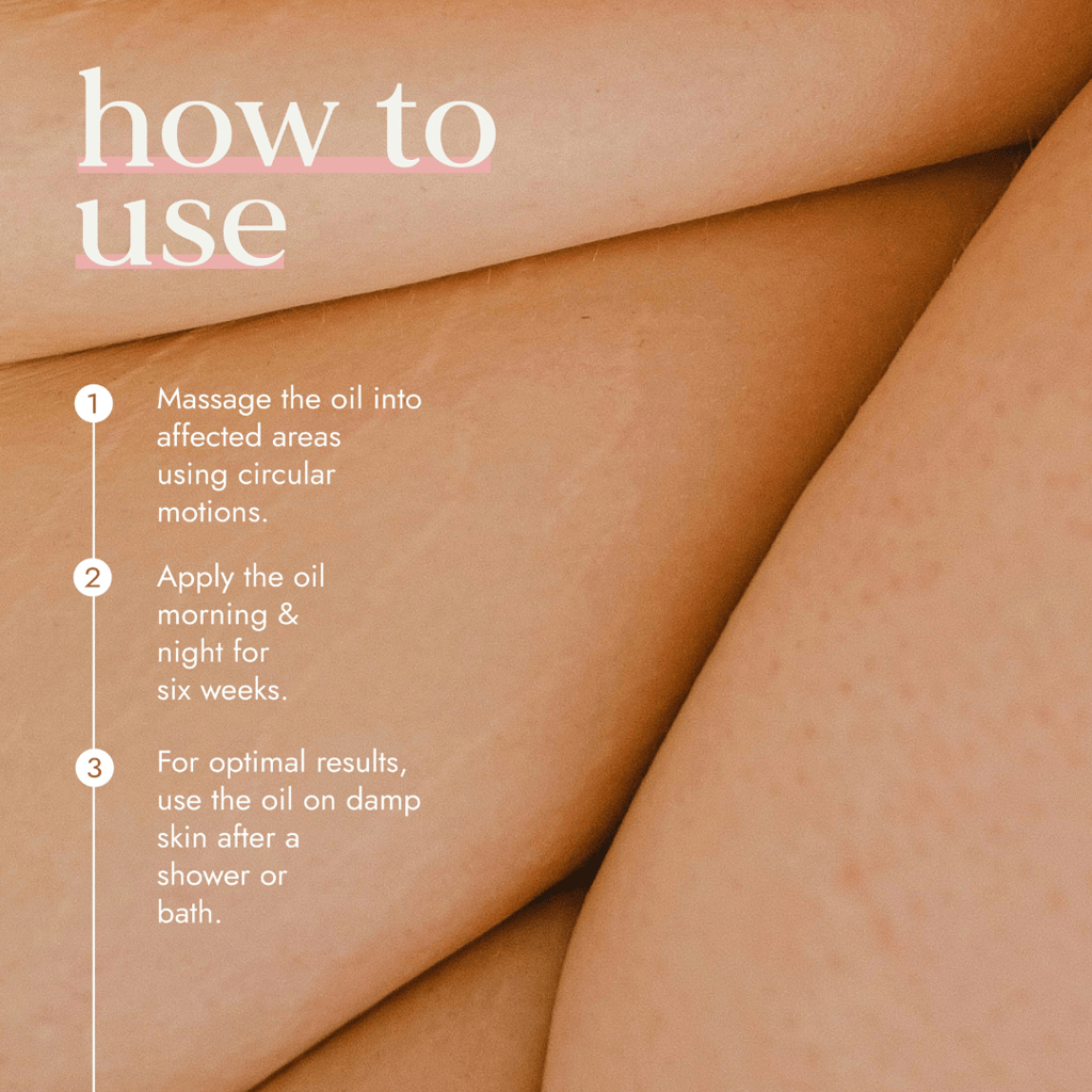 Really Good Stretch Mark Oil - Image 3