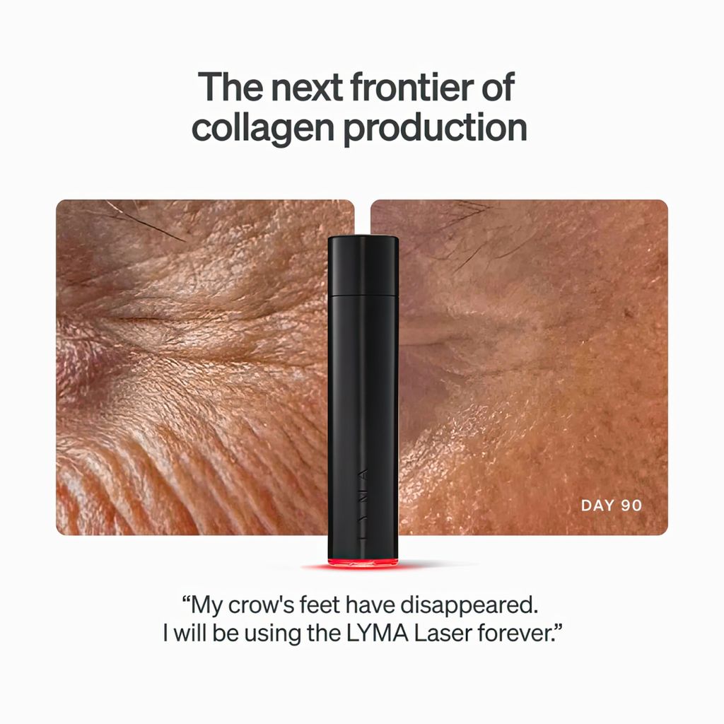 Laser Starter Kit - Image 12