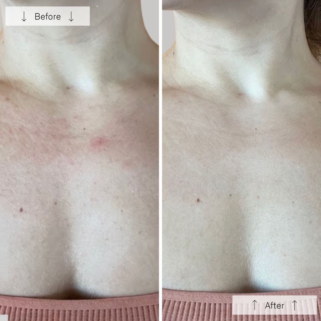 Contour Neck & Decollete - Image 7